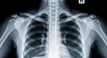 Human Chest X Ray Image Displaying Rib Cage and Spine