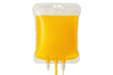 Medical iv drip bag containing yellow plasma, hanging and prepared for patient treatment, isolated on clear background