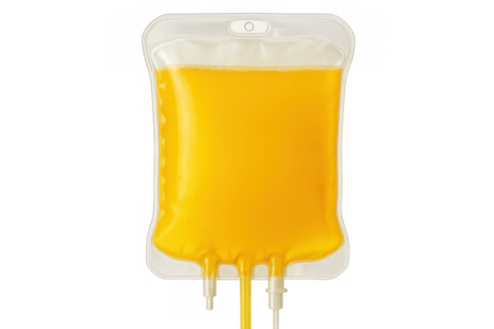 Medical iv drip bag containing yellow plasma, hanging and prepared for patient treatment, isolated on clear background