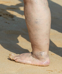 A woman's leg is visible on a sandy beach