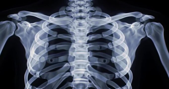 Detailed anterior view of human skeletal structure, showcasing the rib cage, spine, and shoulder bones for medical study and diagnostic purposes. Essential for internal anatomy and health assessment.