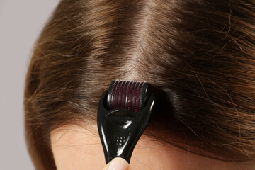 Fototapeta premium Woman using microneedle derma roller on head for stimulating new hair growth. Simple and cheap treatment for the healthy scalp.
