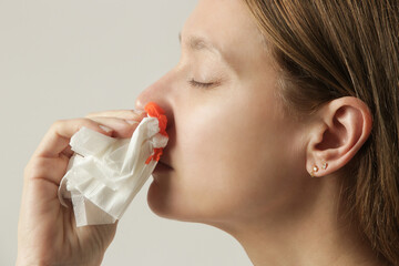 Nosebleed, a young woman with a bloody nose. Healthcare and medical concept. Close up studio image.