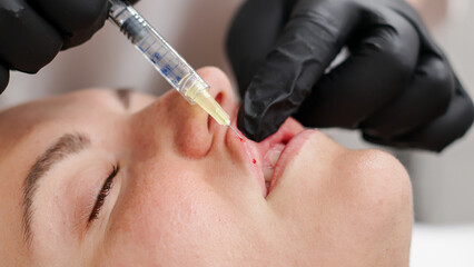 Close-up of cosmetologist hands with syringe making beauty injections into lips of young woman....