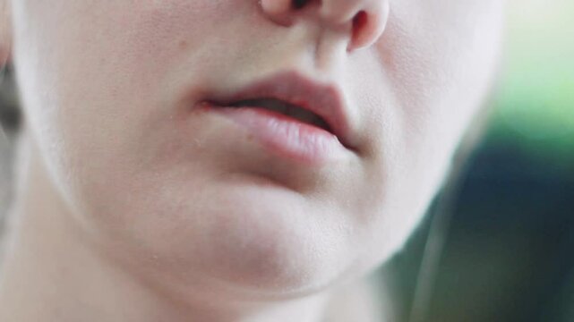 Close-up of a young woman examining her herpes on her lip with her hand. Redness and virus on the lips