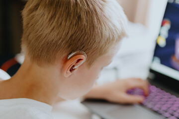 A boy with hearing aids enthusiastically plays computer games, showcasing inclusive play and...