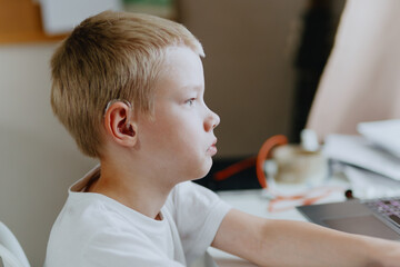 A boy with hearing aids enthusiastically plays computer games, showcasing inclusive play and...