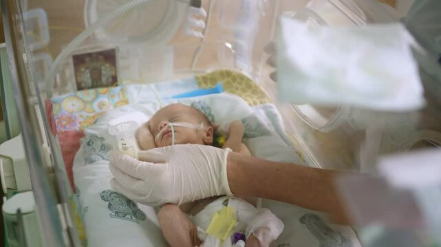 A premature infant is being fed milk in an intensive care unit, highlighting neonatal care and early nutrition. A premature infant receives milk feeding in a neonatal intensive care unit (NICU)