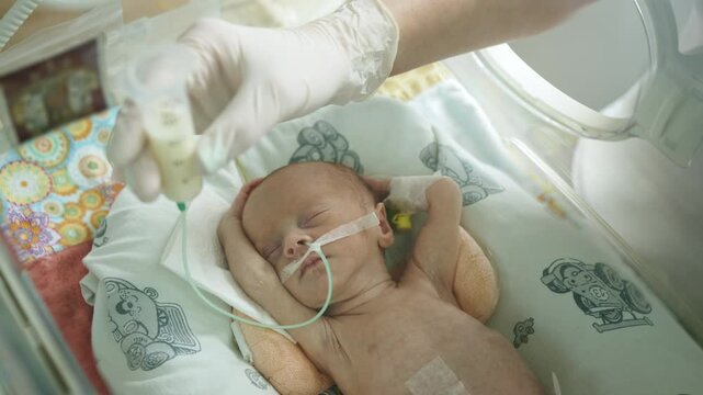A premature infant receives milk feeding in a neonatal intensive care unit, illustrating early nourishment. Premature Infant Milk Feeding