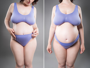 Tummy tuck, fat body before and after weight loss and liposuction on gray background, plastic...