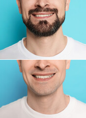 Man before and after shaving on light blue background, closeup. Collage of photos