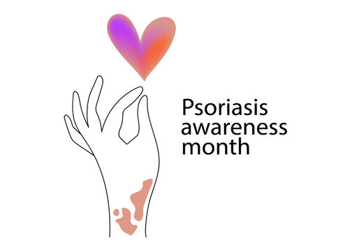 Human hands with symptoms of psoriasis on her skin, banner for Psoriasis awareness month.  Linear  vector illustration.