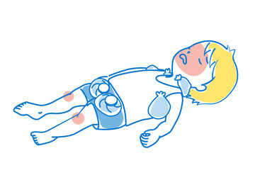 熱中症の応急処置で体を氷で冷却しているイラスト