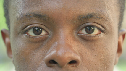 Close-up of Male Eyes and Forehead