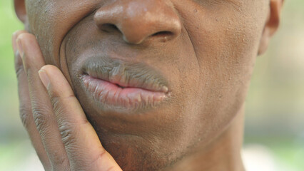 Close-up of a Mouth with Toothache or Facial Pain