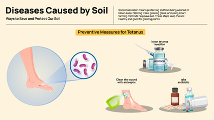 Steps for Soil Conservation Infographic - Simple Techniques to Save and Protect Soil