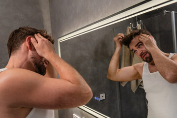 Man Examining Hairline in Mirror Concerned About Hair Loss