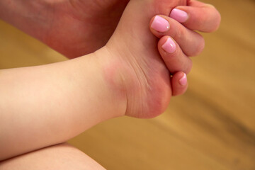A child is sitting on the floor inside a cozy living room, revealing a pronounced red mosquito bite on their knee