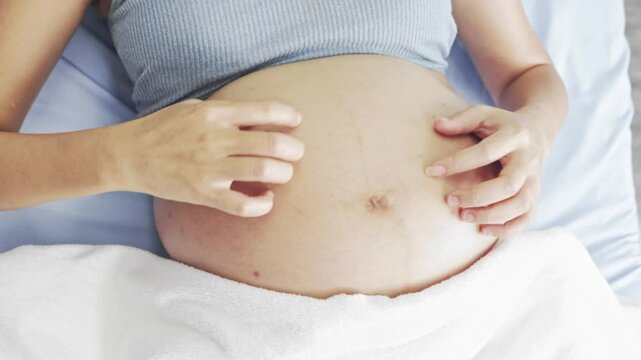 Pregnant Asian woman sits on hospital bed gently scratching and rubbing her belly with both hands relieve itching caused by skin expansion dry cracking and rashes waits doctor to check her pregnancy.

