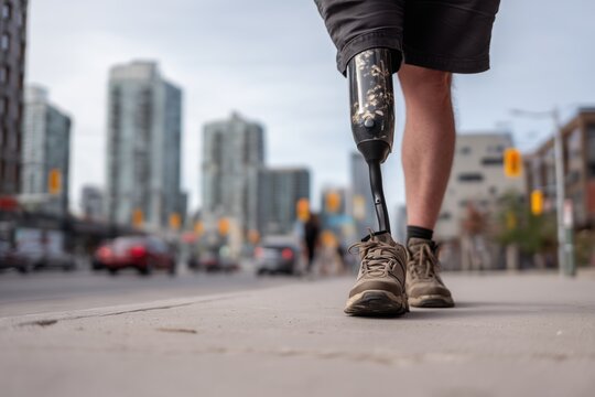 Person with prosthetic leg walks confidently on a city sidewalk, embodying resilience and determination.