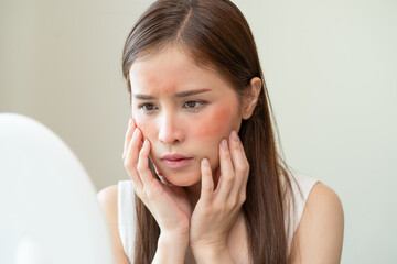 Dermatology, puberty asian young woman, girl looking into mirror, allergy presenting an allergic...