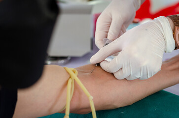 Close up nurse pricking needle syringe in the arm patient drawing blood sample for blood test ,...
