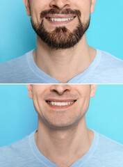 Man before and after shaving on light blue background, closeup. Collage of photos