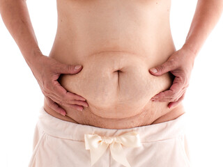 中年太り（女性）