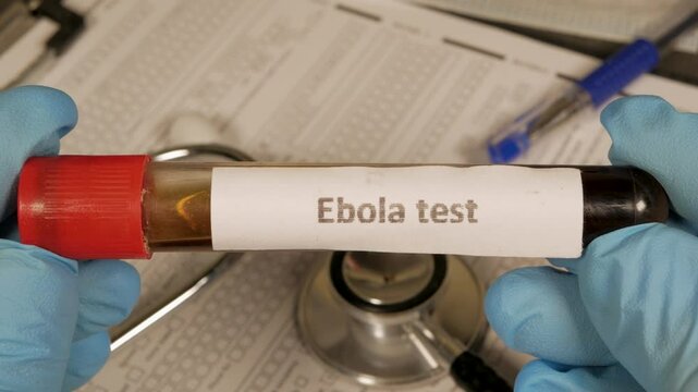 Doctor showing ebola virus blood test sample