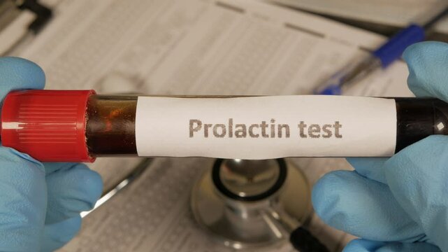 Doctor showing prolactin blood test tube in laboratory