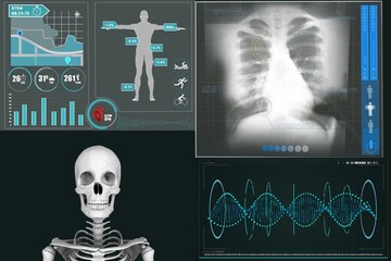 Human skeleton with various medical xray reports