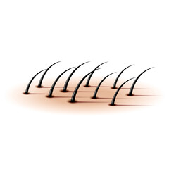 Growing black human hair close-up realistic 3d vector illustration emerging from skin, for dermatology, trichology, cosmetic depilatories, hair transplantation, medical poster or banner design.