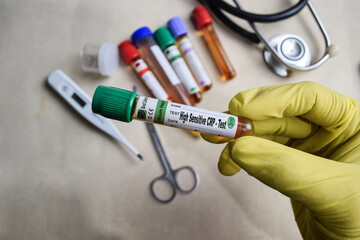 High Sensitive CRP - Test with blood sample in yellow gloved hands. healthcare or Medical concept