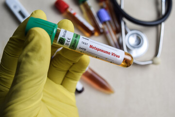 Metapneumo virus - Test with blood sample in yellow gloved hands. healthcare or Medical concept