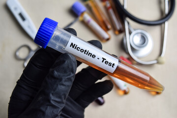 Nicotine - Test with blood sample in black gloved hands. healthcare or Medical concept