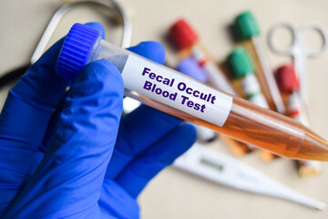 Fecal Occult blood - Test with blood sample in blue gloved hands. healthcare or Medical concept