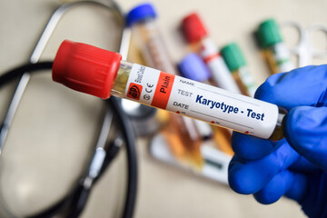 Karyotype - Test with blood sample in blue gloved hands. healthcare or Medical concept