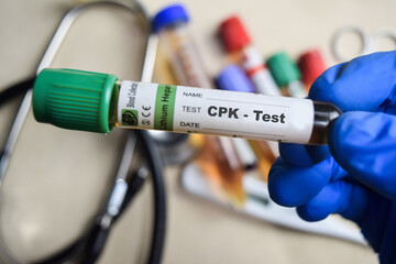 CPK - Test with blood sample in blue gloved hands. healthcare or Medical concept
