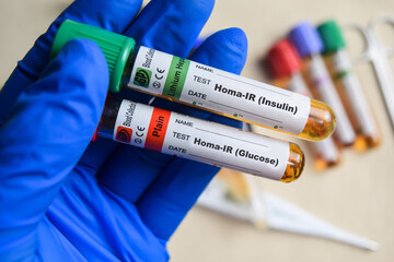 Homa-IR insulin and Homa-IR glucose - Test with blood sample in blue gloved hands. healthcare or...