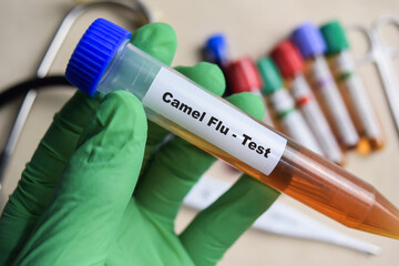 Camel Flu - Test with blood sample in green gloved hands. healthcare or Medical concept