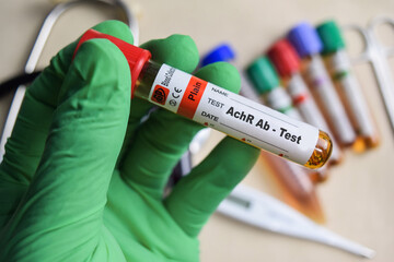 AchR Ab - Test with blood sample in green gloved hands. healthcare or Medical concept