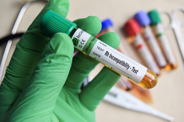 Rh Incompatibility - Test with blood sample in green gloved hands. healthcare or Medical concept