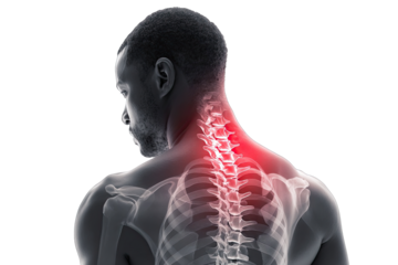 Neck Pain Anatomy