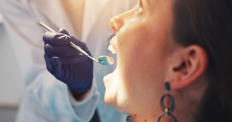 Dental mirror, consultation and dentist with woman for treatment of tooth decay, cavity or oral...