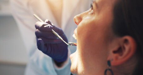 Doctor, patient and hand with mirror at dentist for mouth inspection, gum assessment or exam....