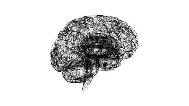 Cerebral blood vessels, animation