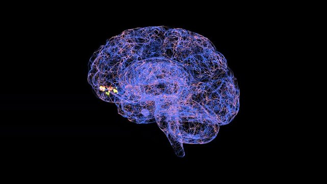Migraine in right orbitofrontal cortex, conceptual animation