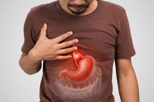 A Hiatal Hernia is illustrated with a line drawing showing the body&rsquo;s internal symptom part of the stomach pushing through the diaphragm into the chest cavity. Stomachache.