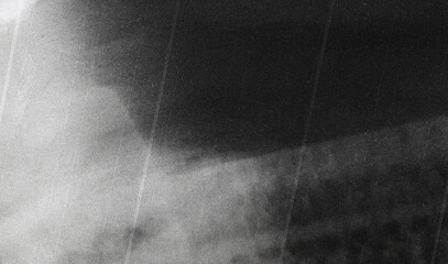 Naklejka premium Old film texture with scratches, noise and glitch shapes. Realistic overlay film texture in black-white, dust and grain. Distressed retro movie or photo negative effect of cinema nostalgia. Artwork