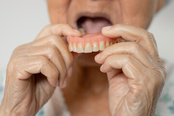 Asian elderly woman patient holding to use denture, healthy strong medical.